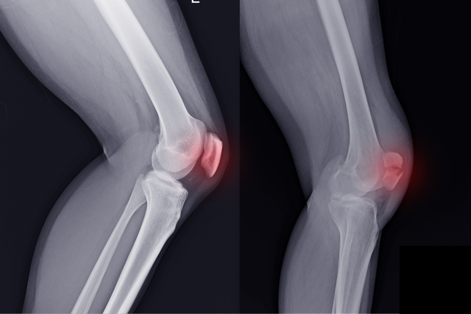 Blogandgoogleupdatephotos28429