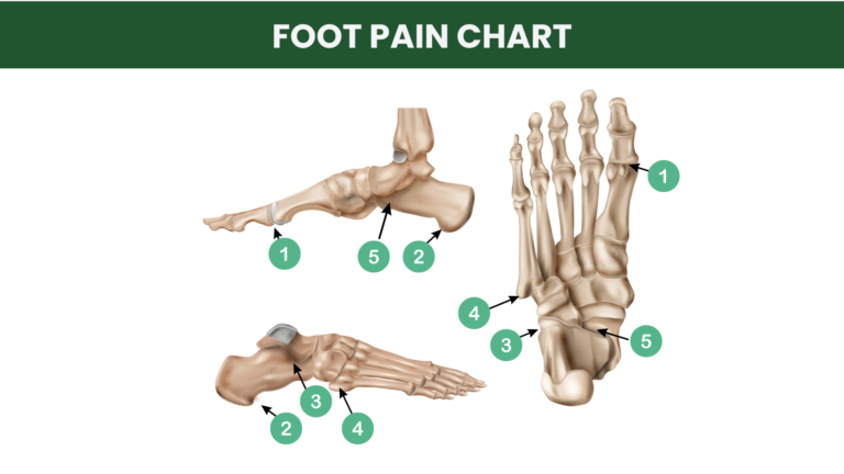 Foot pain chart