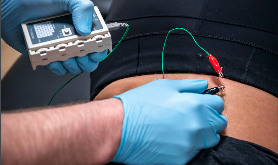 IMS Dry Needling