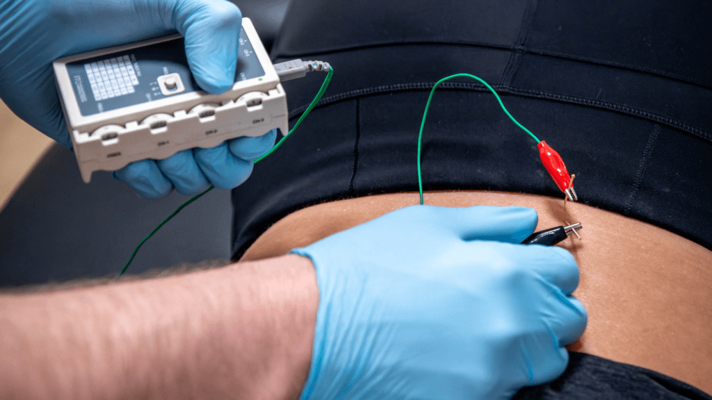 Dry Needling or IMS by physio in Victoria BC